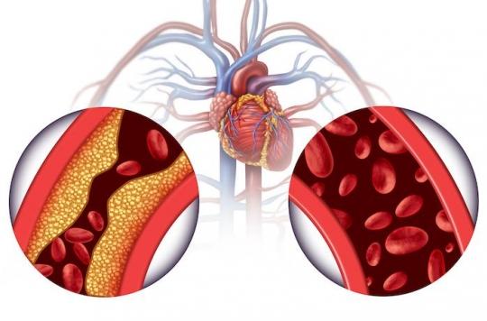 Lire la suite à propos de l’article Hypertension Artérielle Soin Naturel